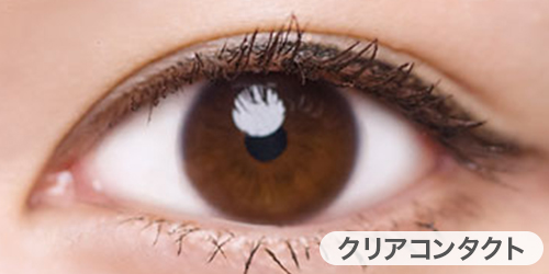 クリアコンタクト装着写真