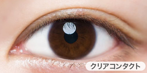 クリアコンタクト装着写真